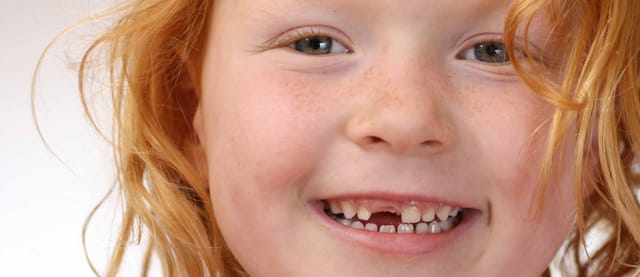 Childs Tooth Development