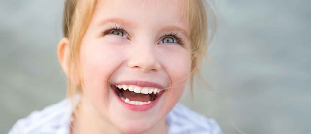 Tooth Colored Fillings